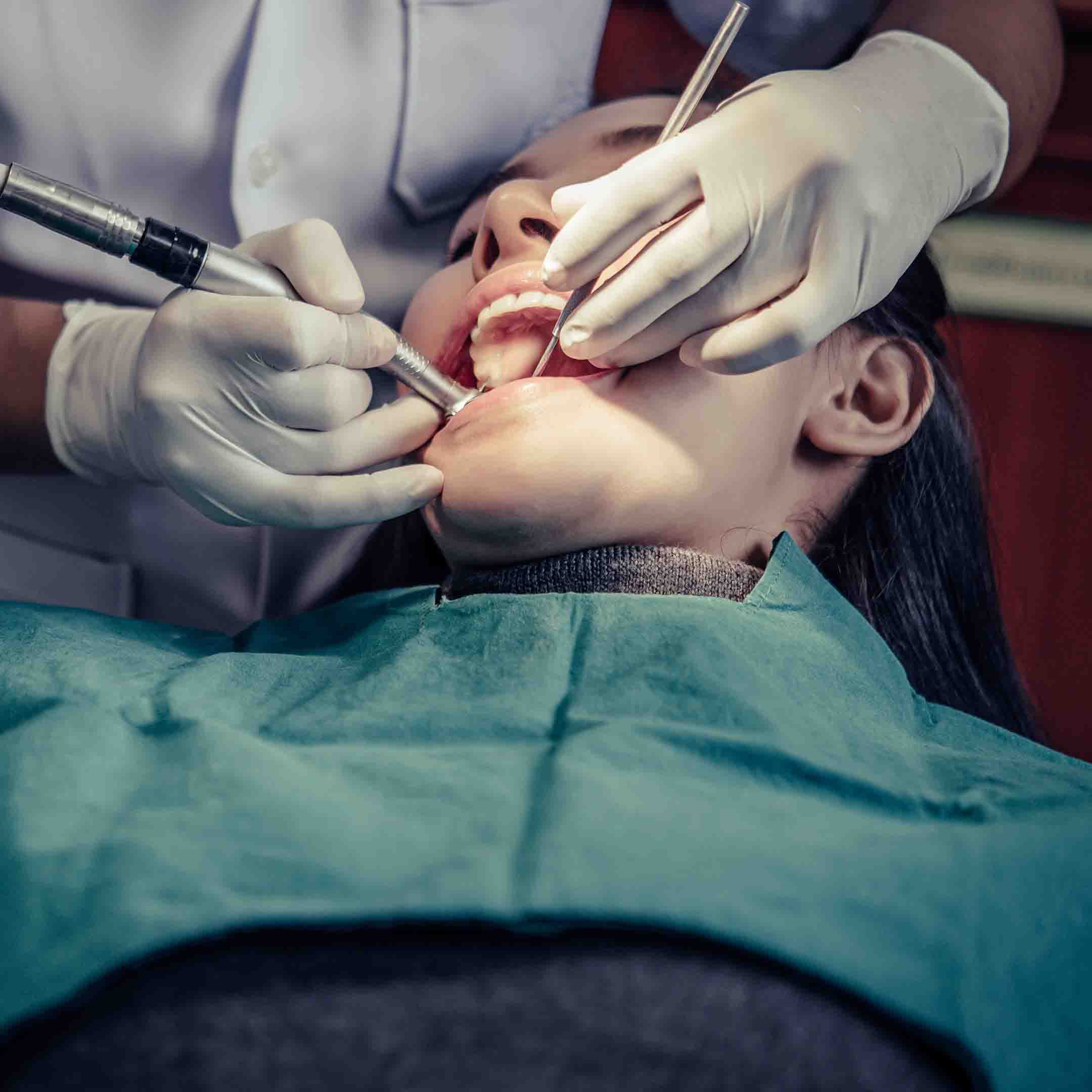 Purpose of Wisdom Teeth Removal