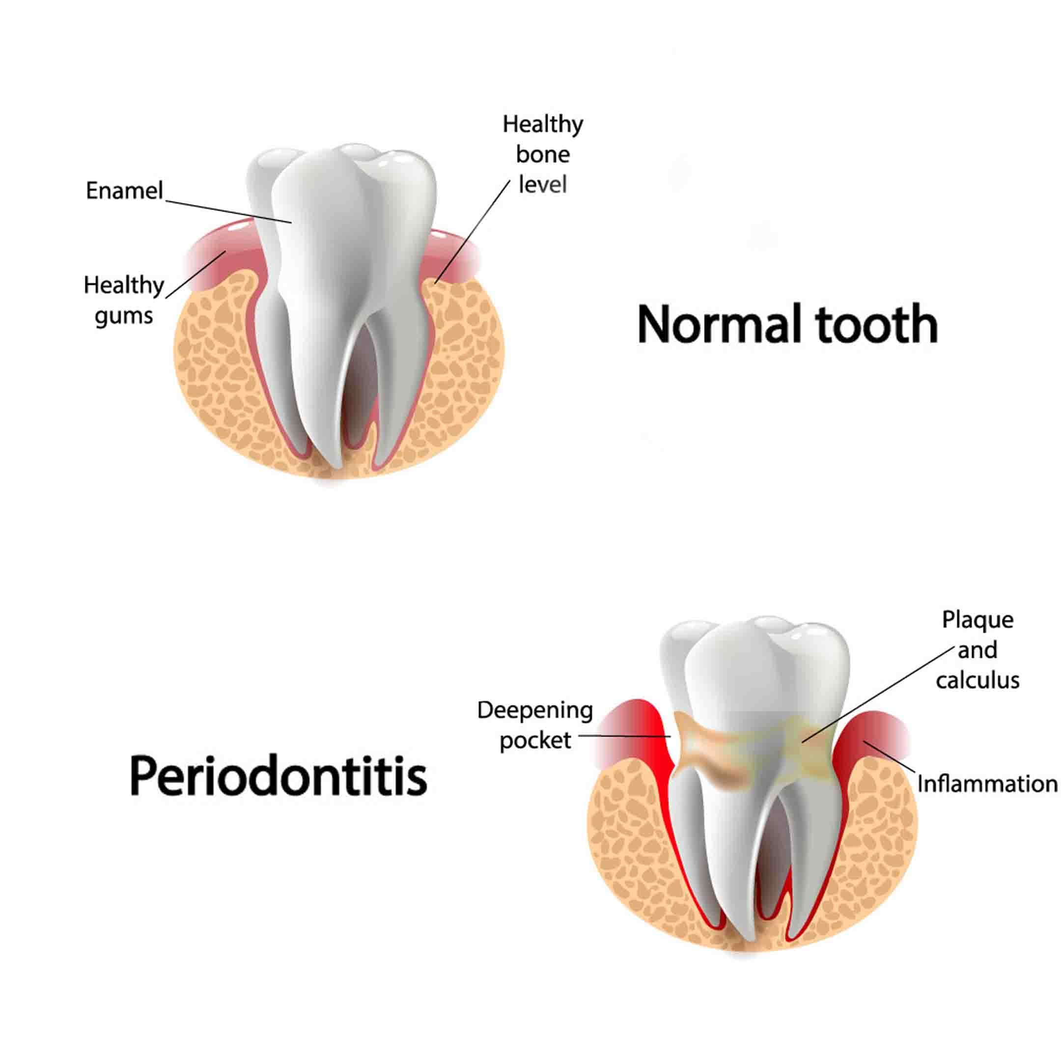 What are the risk factors for periodontists?